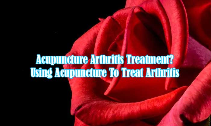 Acupuncture Arthritis Treatment? Using Acupuncture To Treat Arthritis